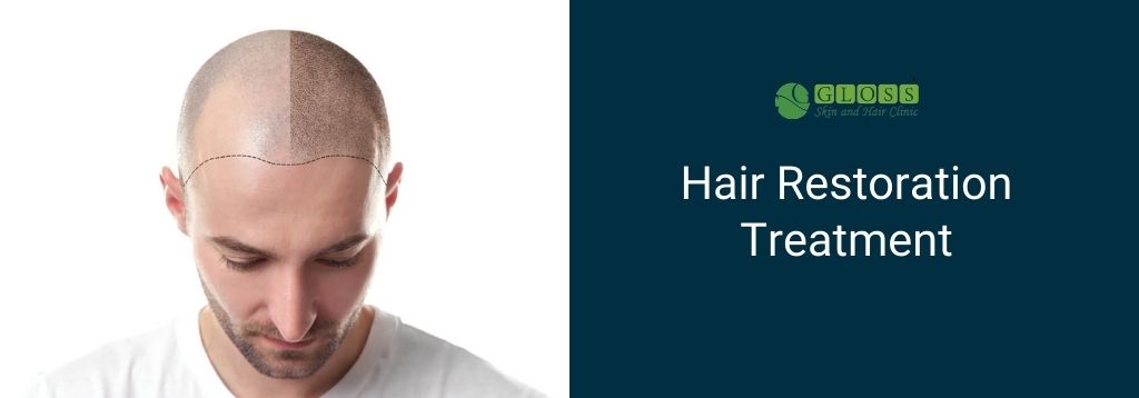 Hair Transplant Surgery | Non Surgical Hair Transplant - Hair Treatment Andheri West Mumbai Hair Transplant Surgery | Non Surgical Hair Transplant - Hair Treatment Andheri West Mumbai