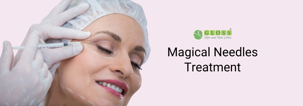 magical-needles-treatment-in-mumbai-gloss-clinic.png